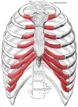 costochondritis