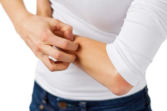 fibromyalgia formication