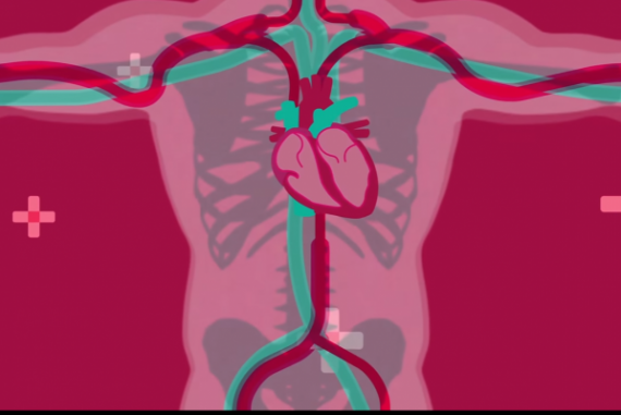 cardiomyopathy in fibromyalgia