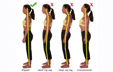 posture correction for fibromyalgia
